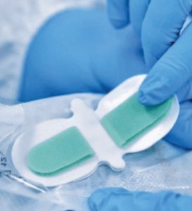 Medical Fixation Devices | Skin-friendly Adhesives | PolarSeal